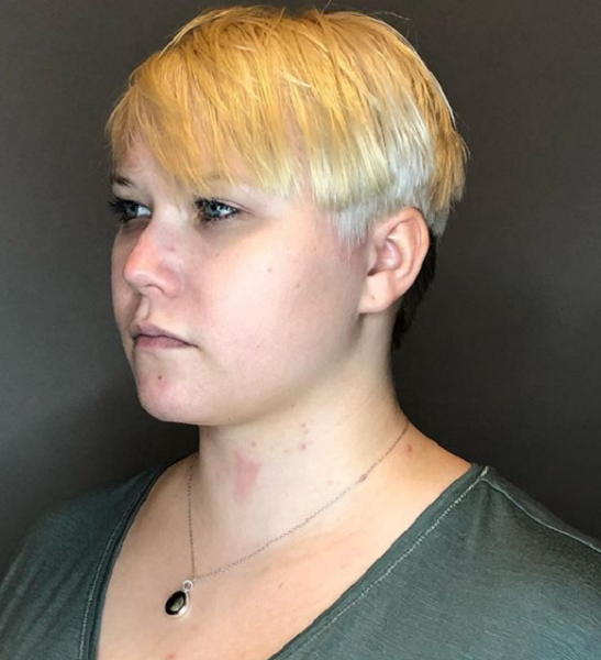 Blonde Layered Wedge Haircut with Dark Nape Undercut
